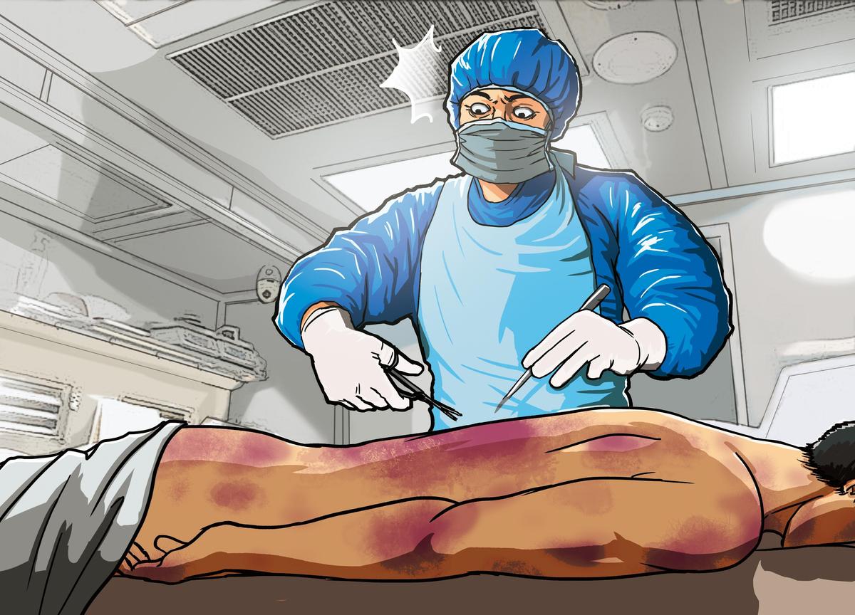 法醫解剖時發現，死者陳瑞卿身上有外力造成的傷痕。