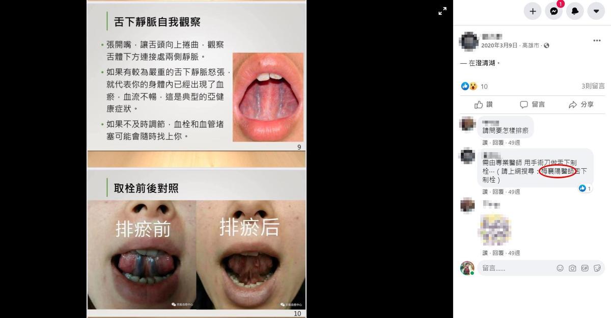 有網友於臉書分享「舌下取栓」，甚至還推薦民眾可以上網搜尋梅襄陽醫師。（翻攝自臉書）