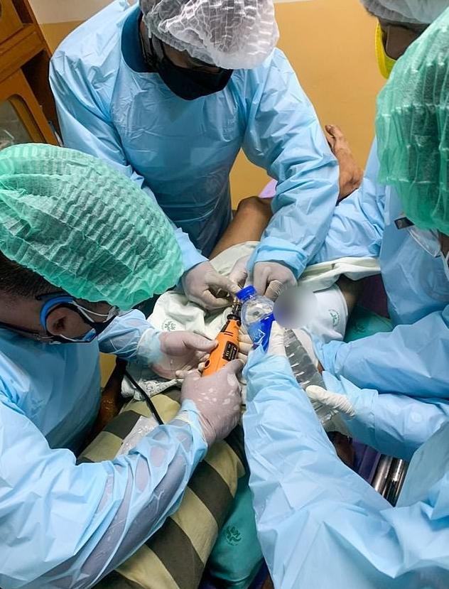 男子被送醫後，醫師用電動刀具切開鎖頭。（翻攝自YouTube）