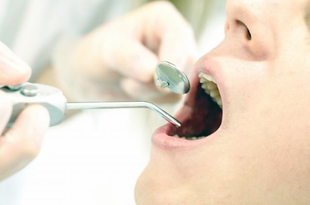 醫師提醒，若放任蛀牙不管，可能會引起齒源性蜂窩性組織炎。（示意圖，photoAC）