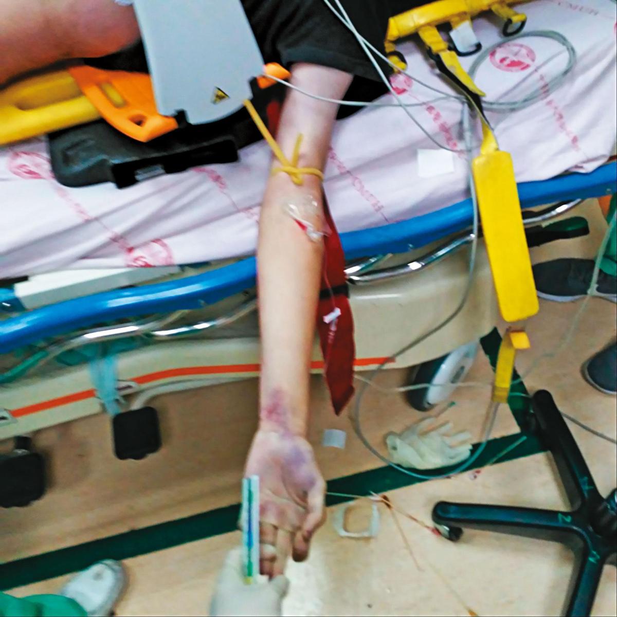 賴男在救護車內使用心肺復甦機急救，送抵醫院後緊急插針，專案小組認為賴男手部針孔是醫護急救所致。（家屬提供）
